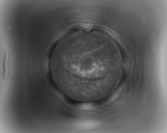 X0000099950462200805301239