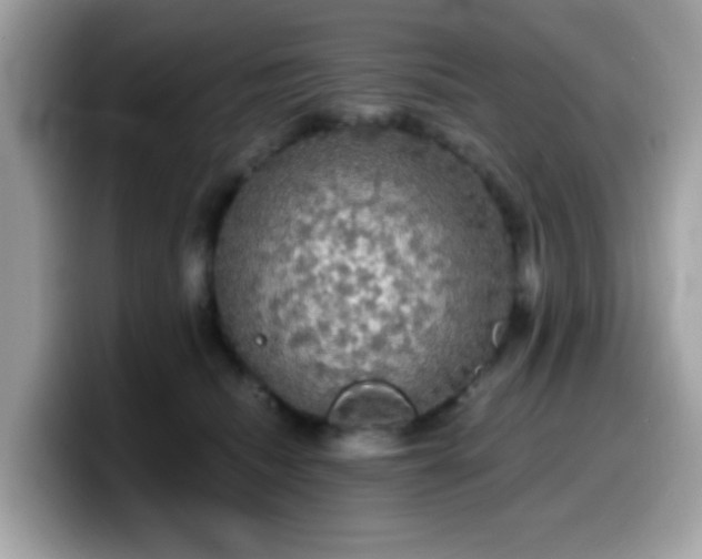 X0000099950468200805301239