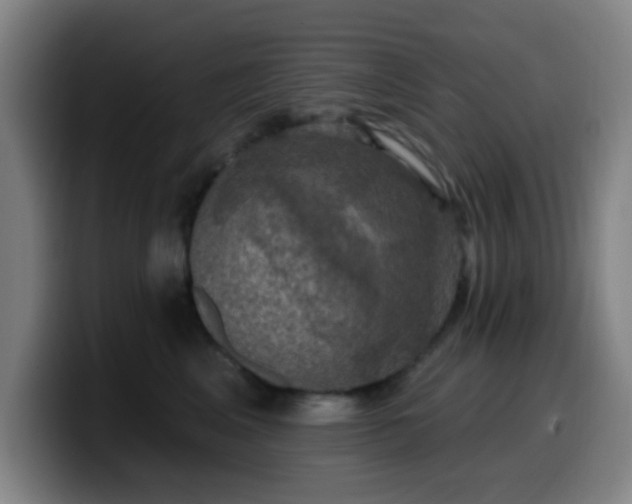X0000099950617200805301237