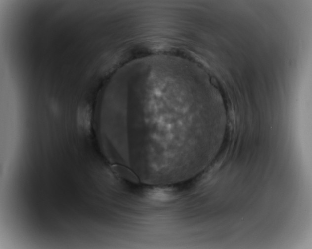 X0000099950664200805301237