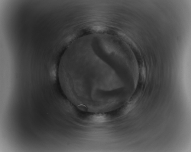 X0000099950668200805301237