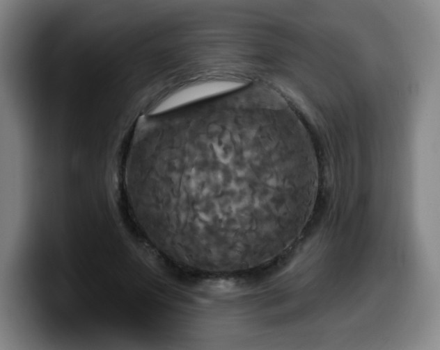 X0000099950687200805301236