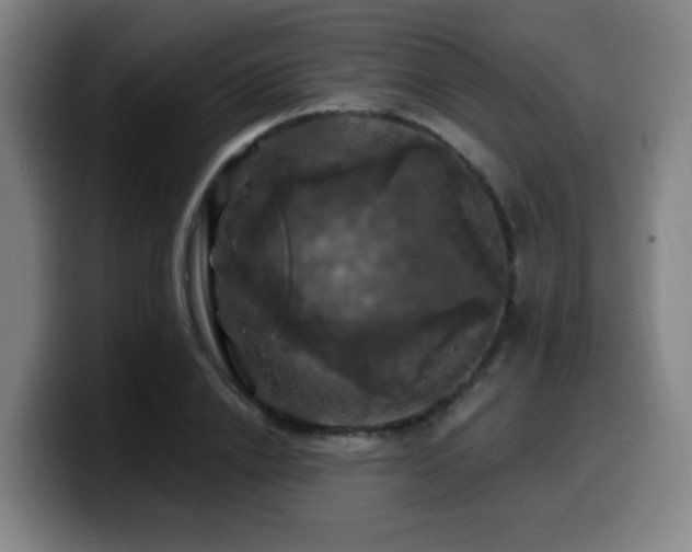 X0000099950838200805301235