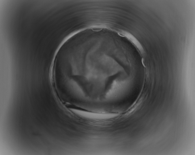 X0000099951052200805301233