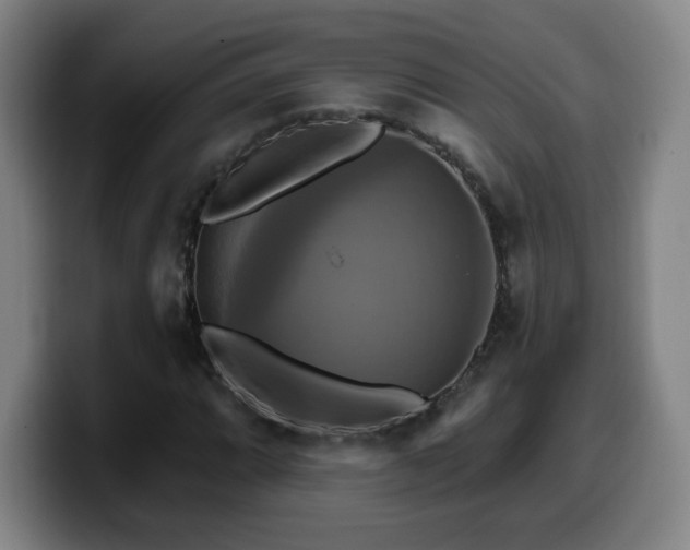 X0000099951064200805301232