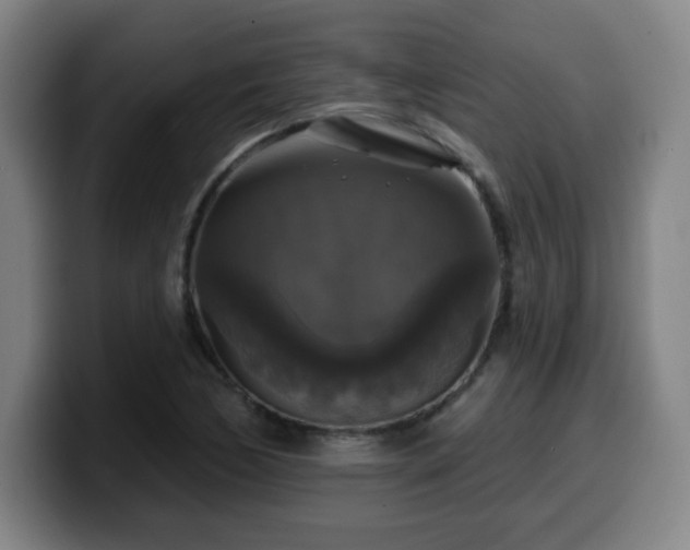 X0000099951170200805301231