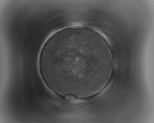 X0000099951475200805301227