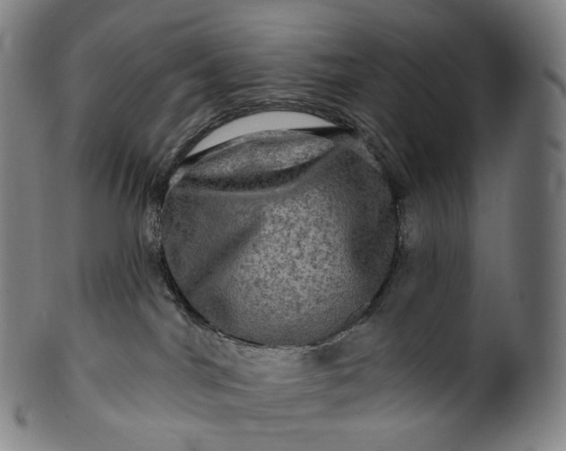 X0000099950044200806061553