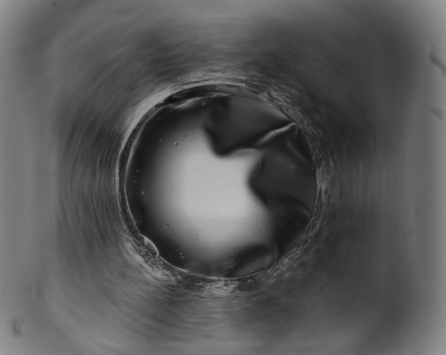 X0000099950148200806061550