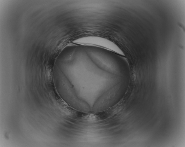 X0000099950276200806061549