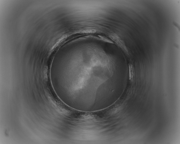 X0000099950300200806061548