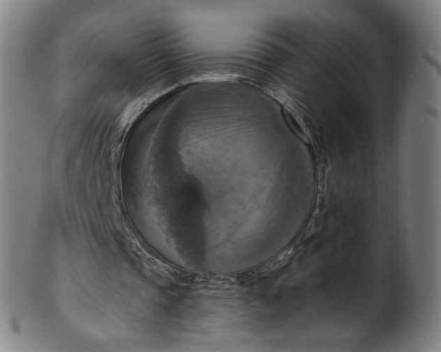 X0000099950337200806061547