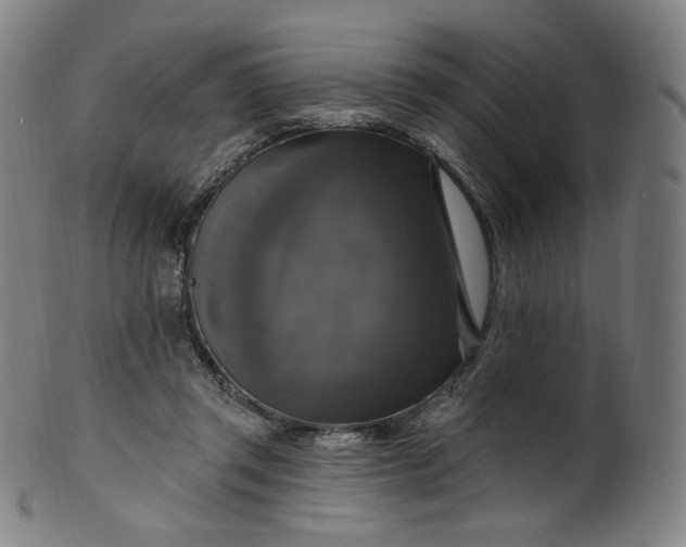 X0000099950357200806061547