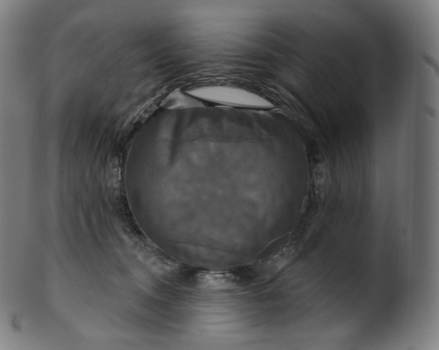 X0000099950372200806061548