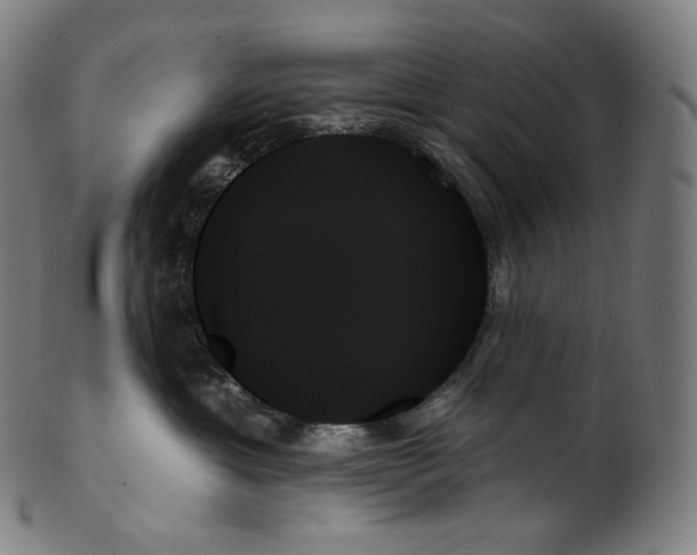 X0000099950429200806061546