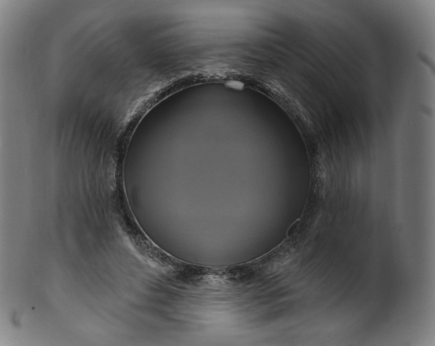 X0000099950496200806061545