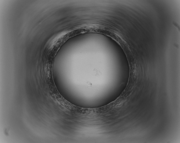 X0000099951016200806061537