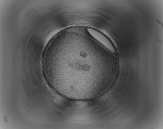 X0000099951085200806061536