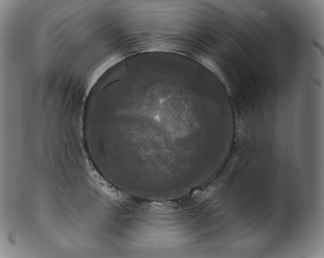 X0000099951138200806061536