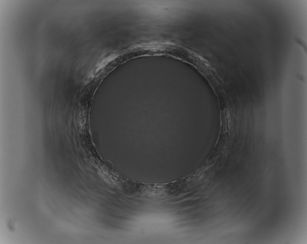 X0000099951158200806061535