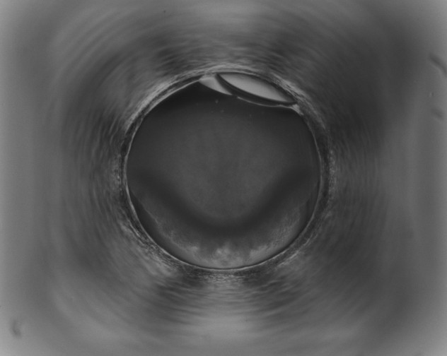 X0000099951170200806061535