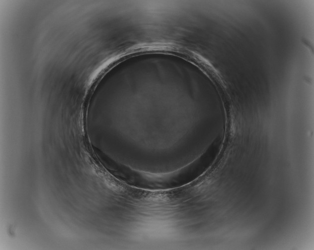 X0000099951174200806061535