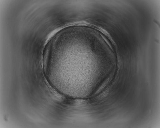 X0000099951176200806061535