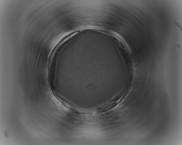 X0000099951244200806061535