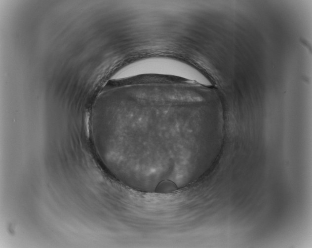X0000099950022200806131457