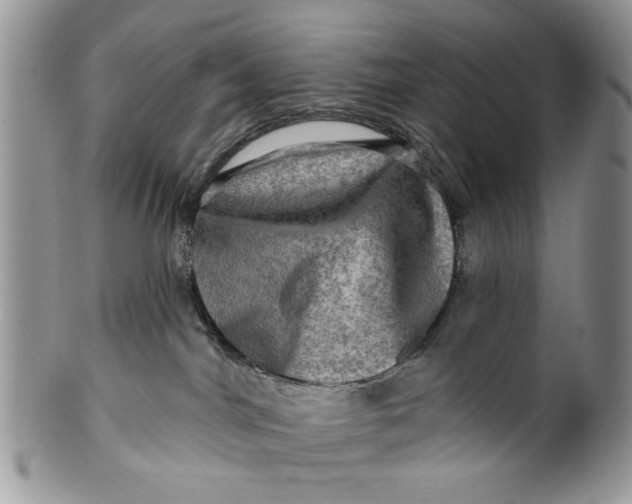 X0000099950044200806131457