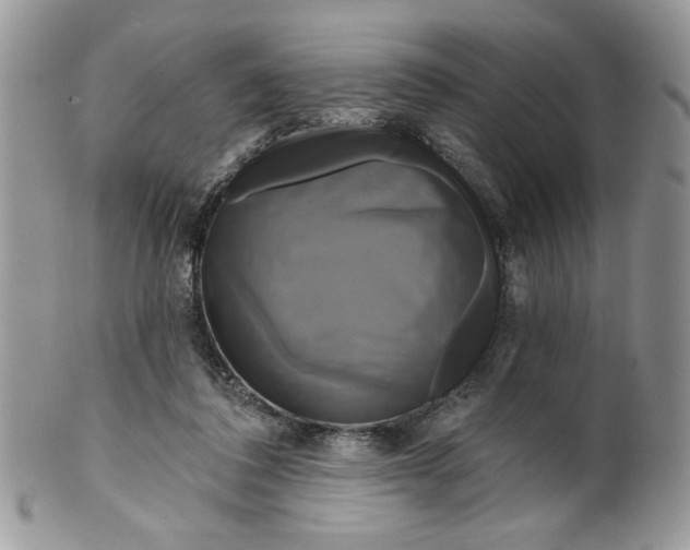 X0000099950308200806131453