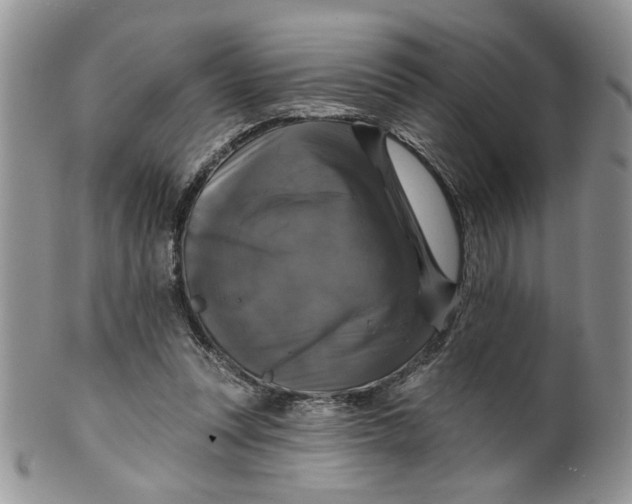 X0000099950351200806131453