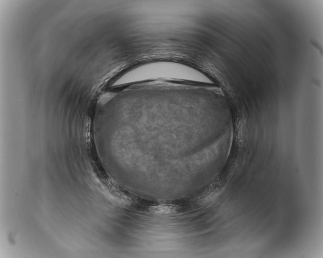 X0000099950356200806131453