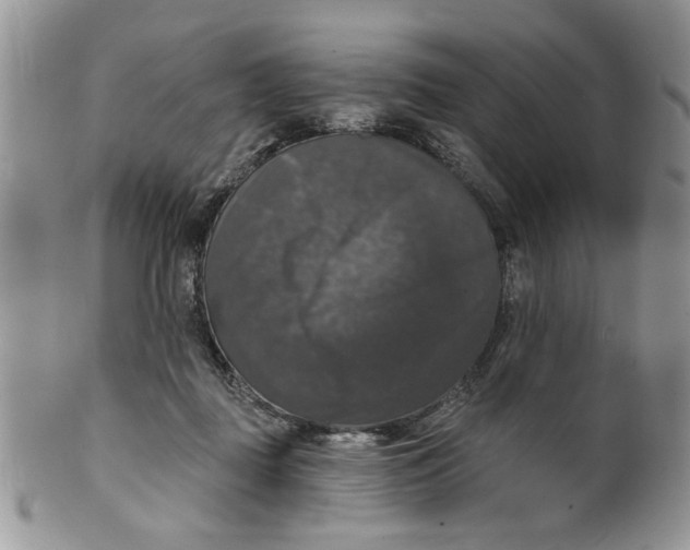 X0000099950363200806131453
