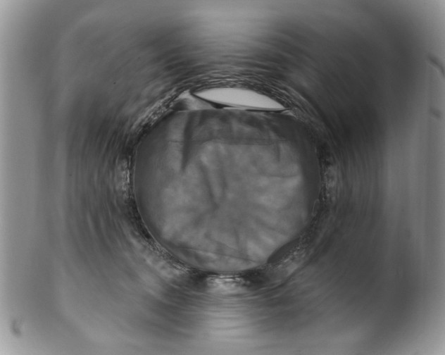 X0000099950372200806131453