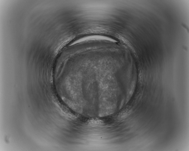 X0000099950403200806131452