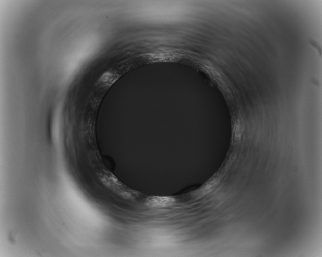 X0000099950429200806131451