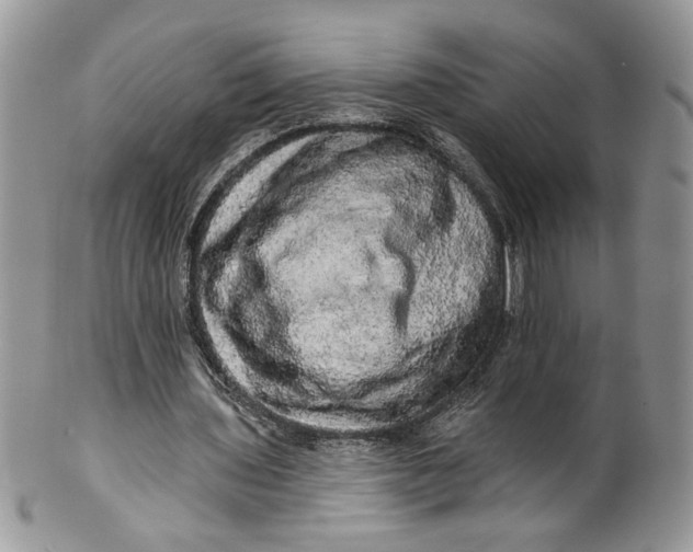 X0000099950435200806131451