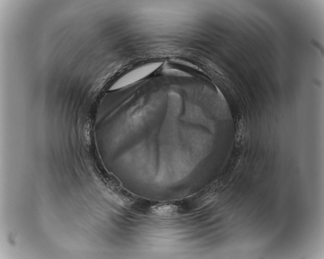 X0000099950452200806131451