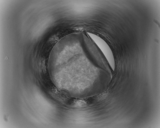 X0000099950572200806131450