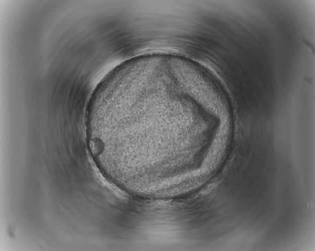 X0000099951038200806131443