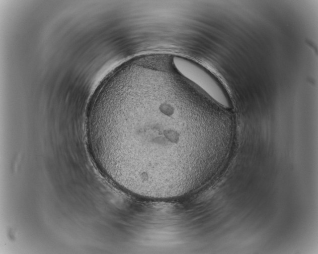 X0000099951085200806131442