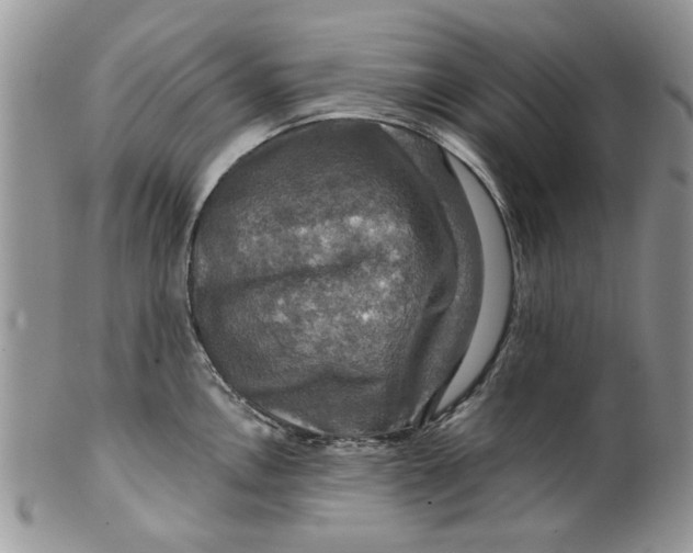 X0000099951146200806131442