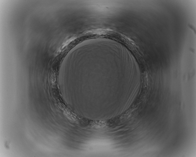 X0000099951158200806131441