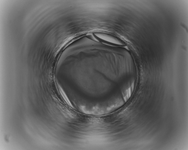 X0000099951170200806131441