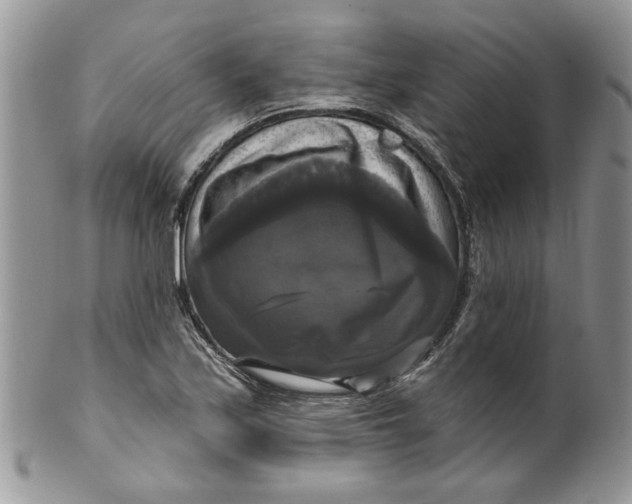 X0000099951171200806131441