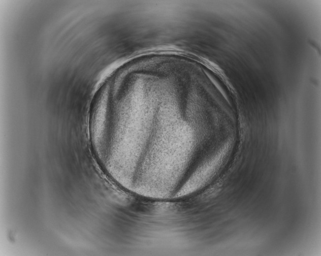 X0000099951176200806131441