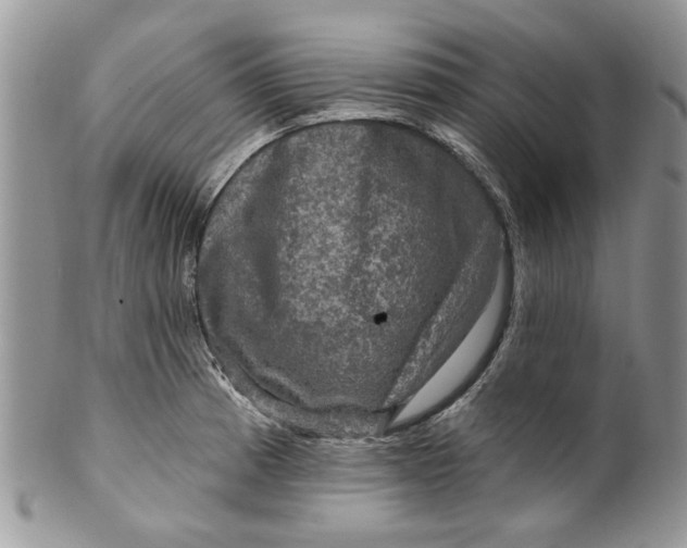 X0000099951185200806131441