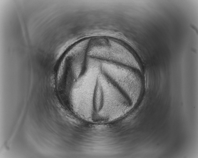 X0000099951501200806131436