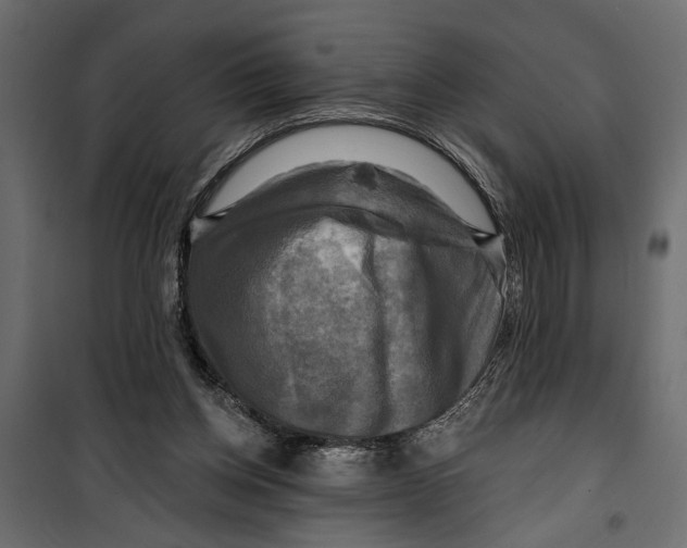 X0000099950158200806201322